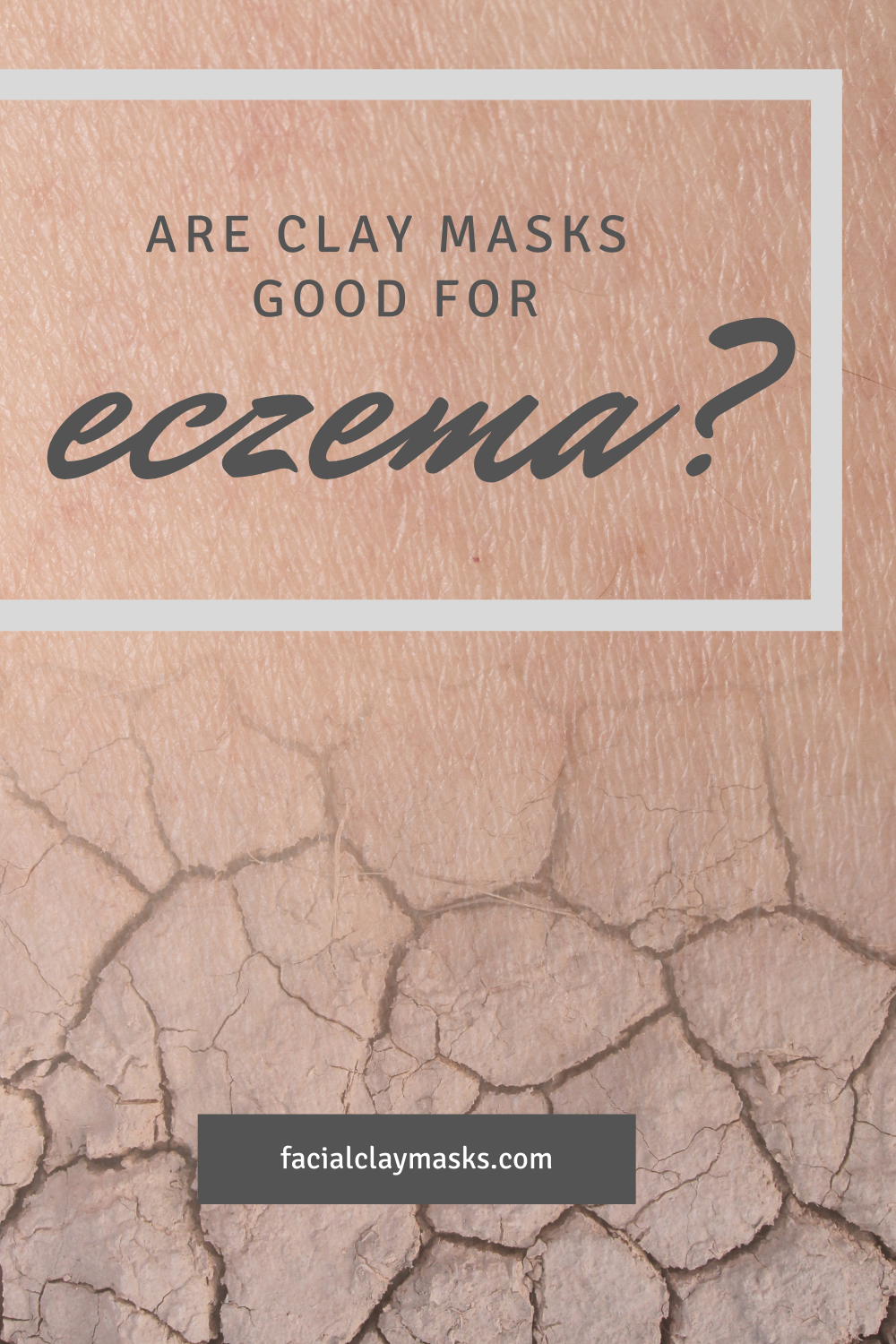 Are clay masks good for Eczema? 1