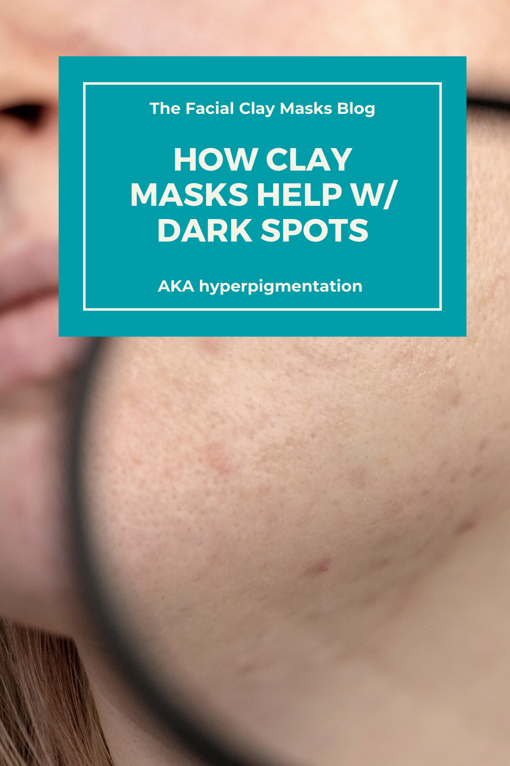 Are Clay Masks good for Dark Spots? 1