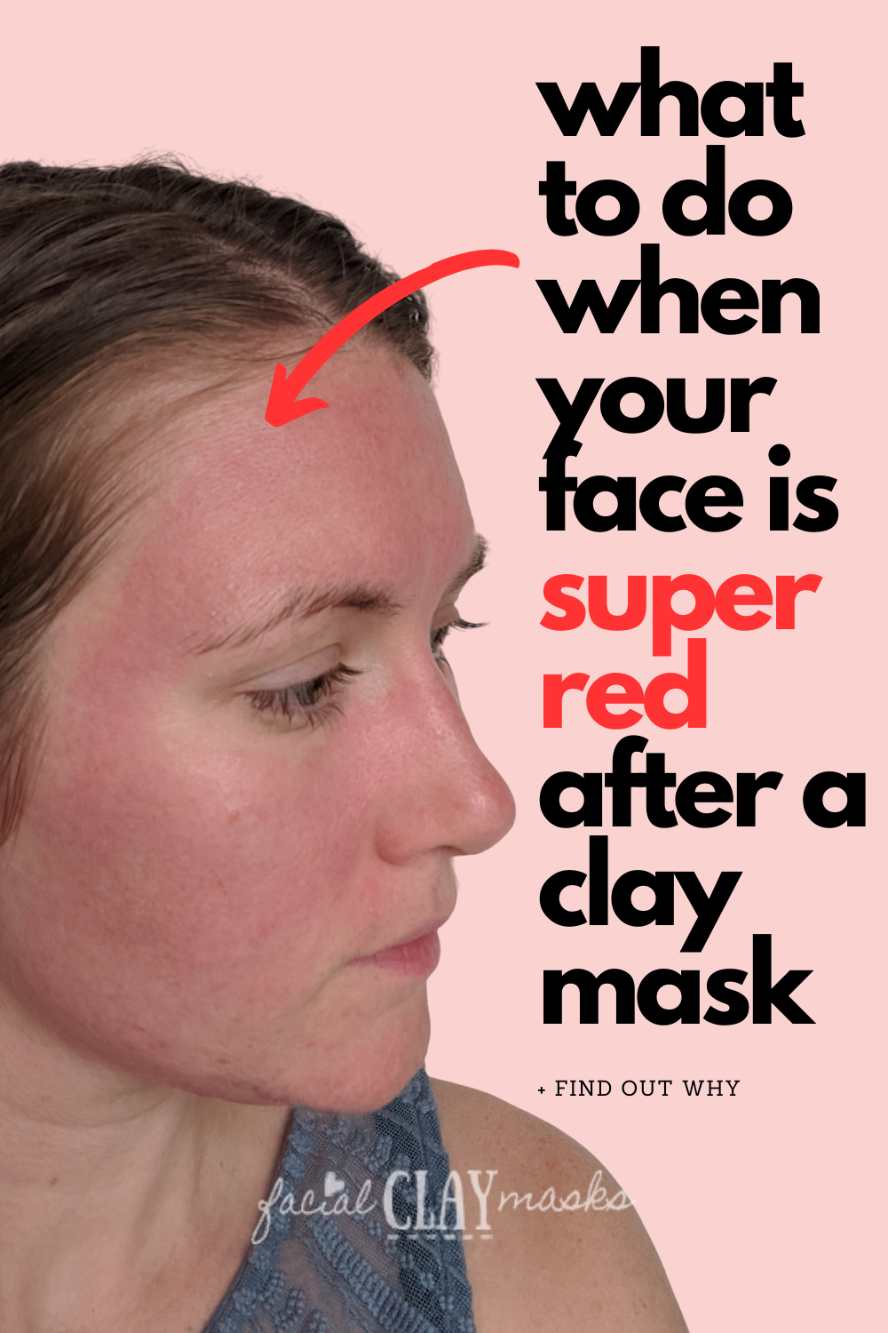 Is Redness after a Clay Mask normal? 1