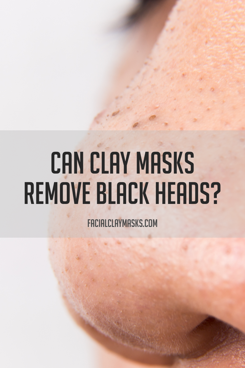 Can a Clay Mask remove Blackheads? 1