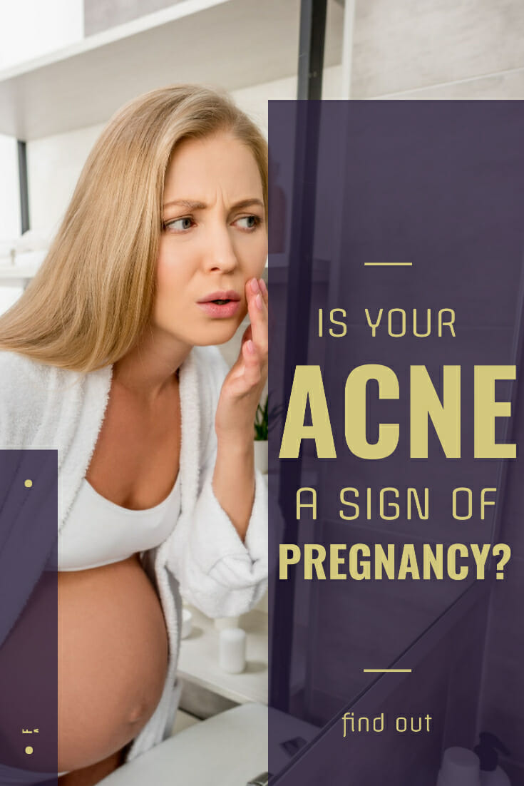 Is Acne a Sign of Pregnancy
