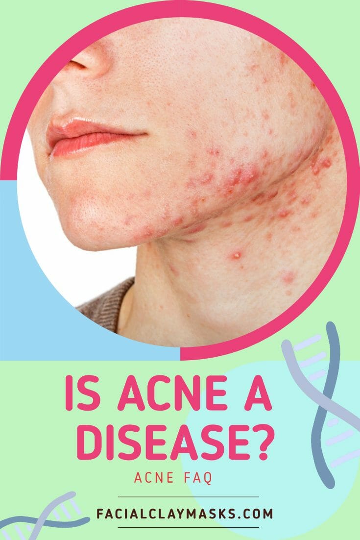 Is acne a disease?